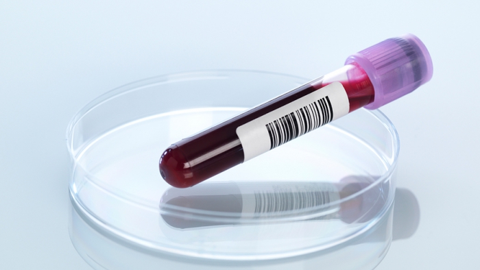 TES LED WESTERGREN: ALAT DIAGNOSTIK UTAMA UNTUK MENDETEKSI INFLAMASI ...